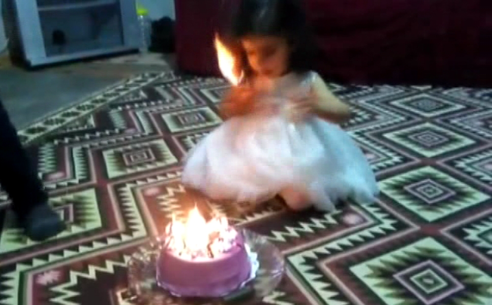 Küçük kız pastasını üflerken kendini yakıyordu