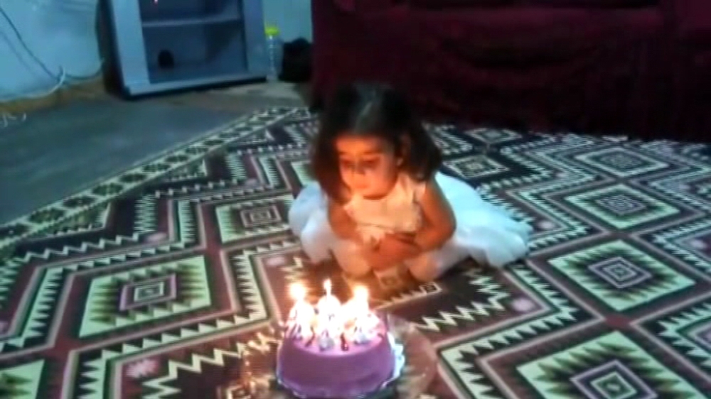 Küçük kız pastasını üflerken kendini yakıyordu