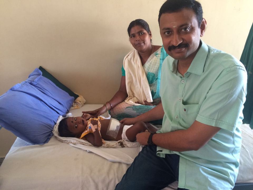 Hindistan'da bebeğin karnından ikizi çıktı