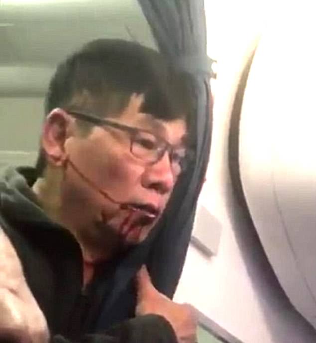 United Airlines yolcusunu akrep ıssırdı