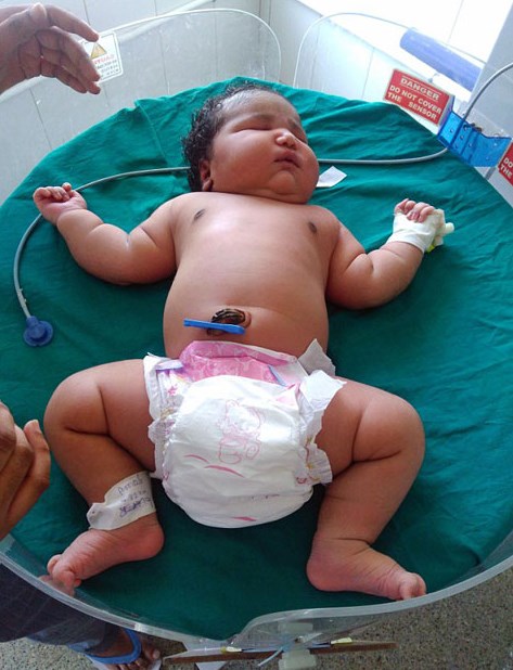 Dünyanın en kilolu kız bebeği Hindistan'da doğdu